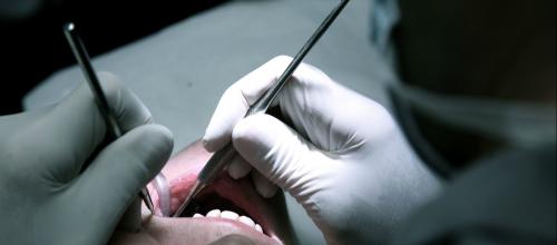 Tandpinen kureres igen gratis for socialt udsatte 